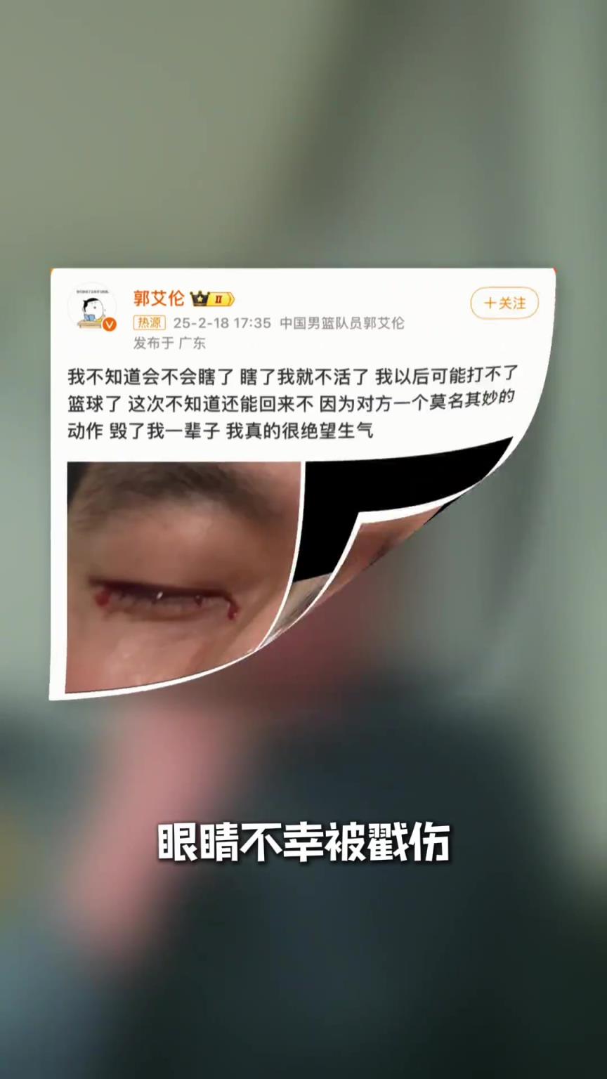 专业医生谈郭艾伦眼伤：大家不要太担心，大概率可以恢复的